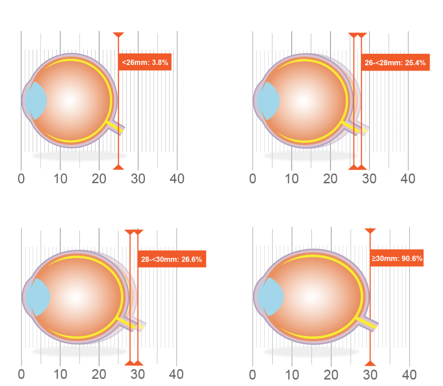 Axial Length with risk of uncorrectable visual impairment