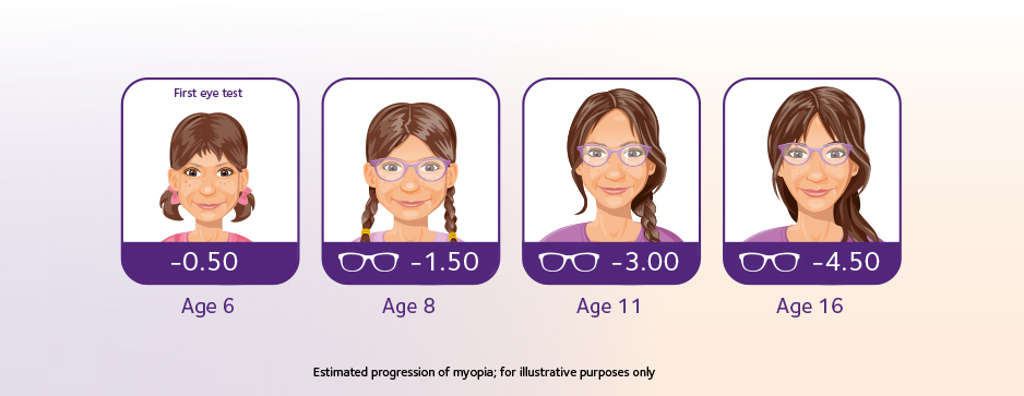 myopia in children