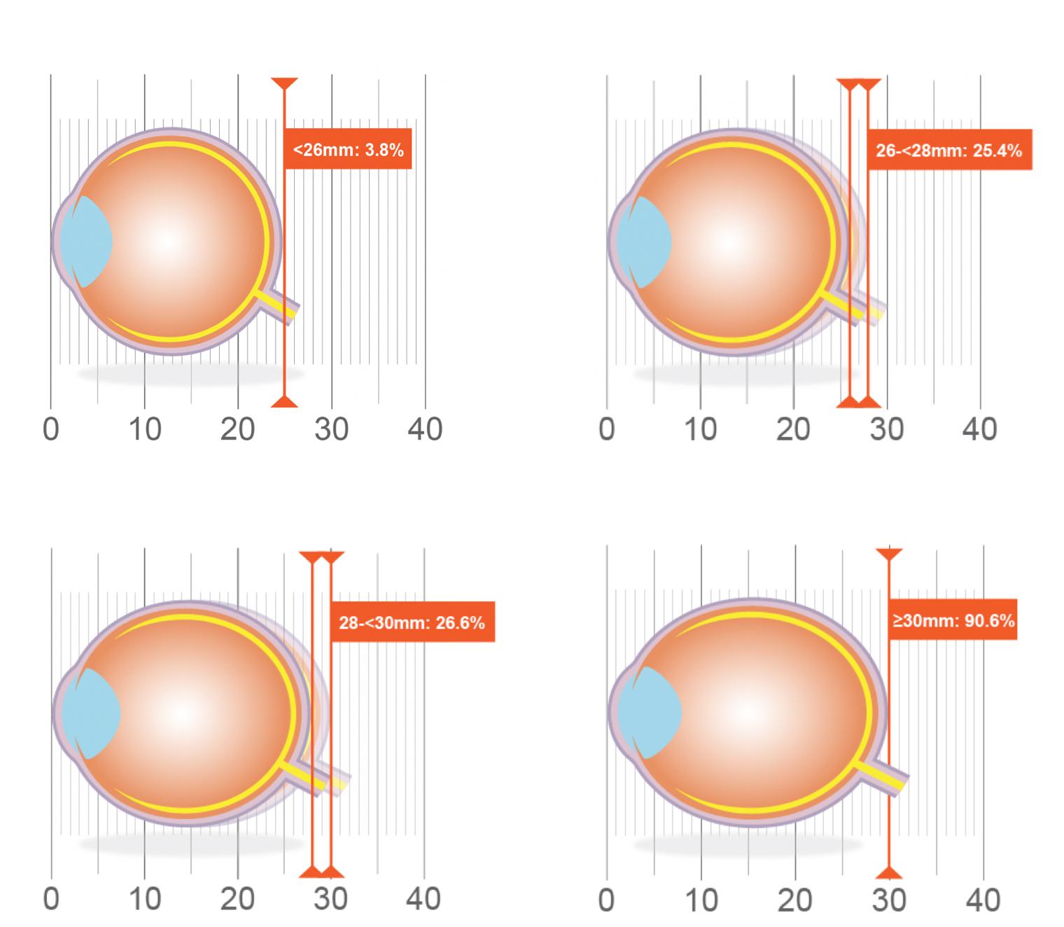 Axial Length with risk of uncorrectable visual impairment