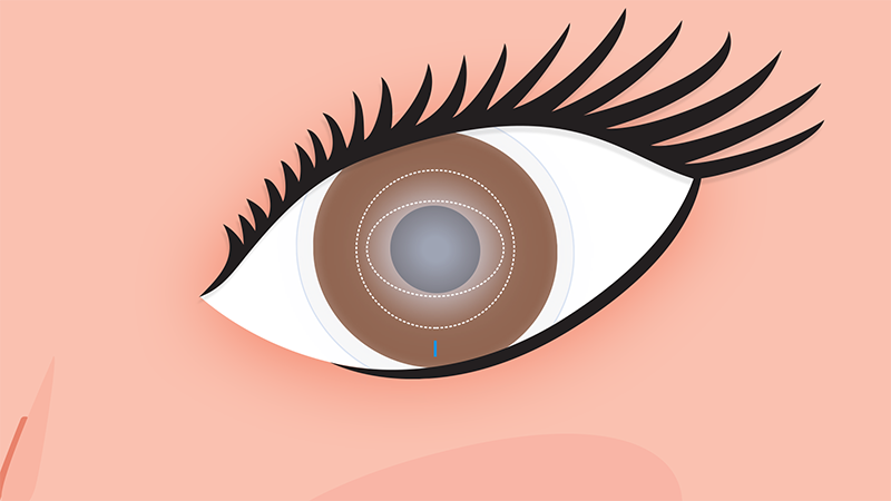 Optimised Toric Lens Geometry™